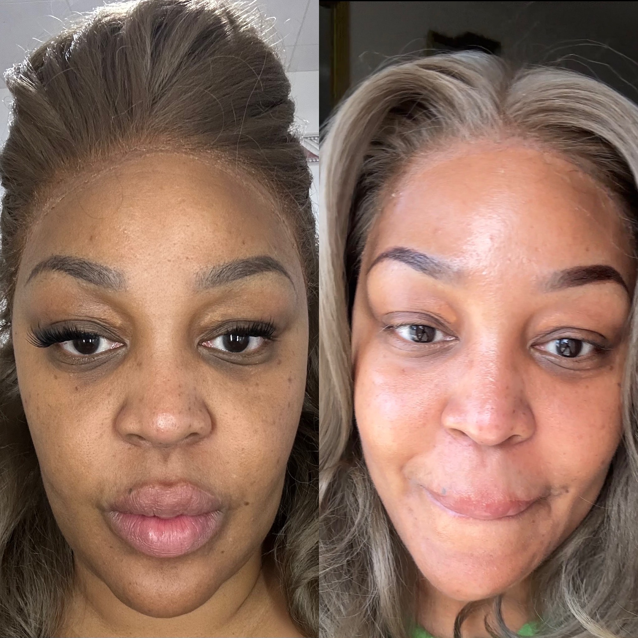 Melissa shares a side-by-side photo from her personal skincare test